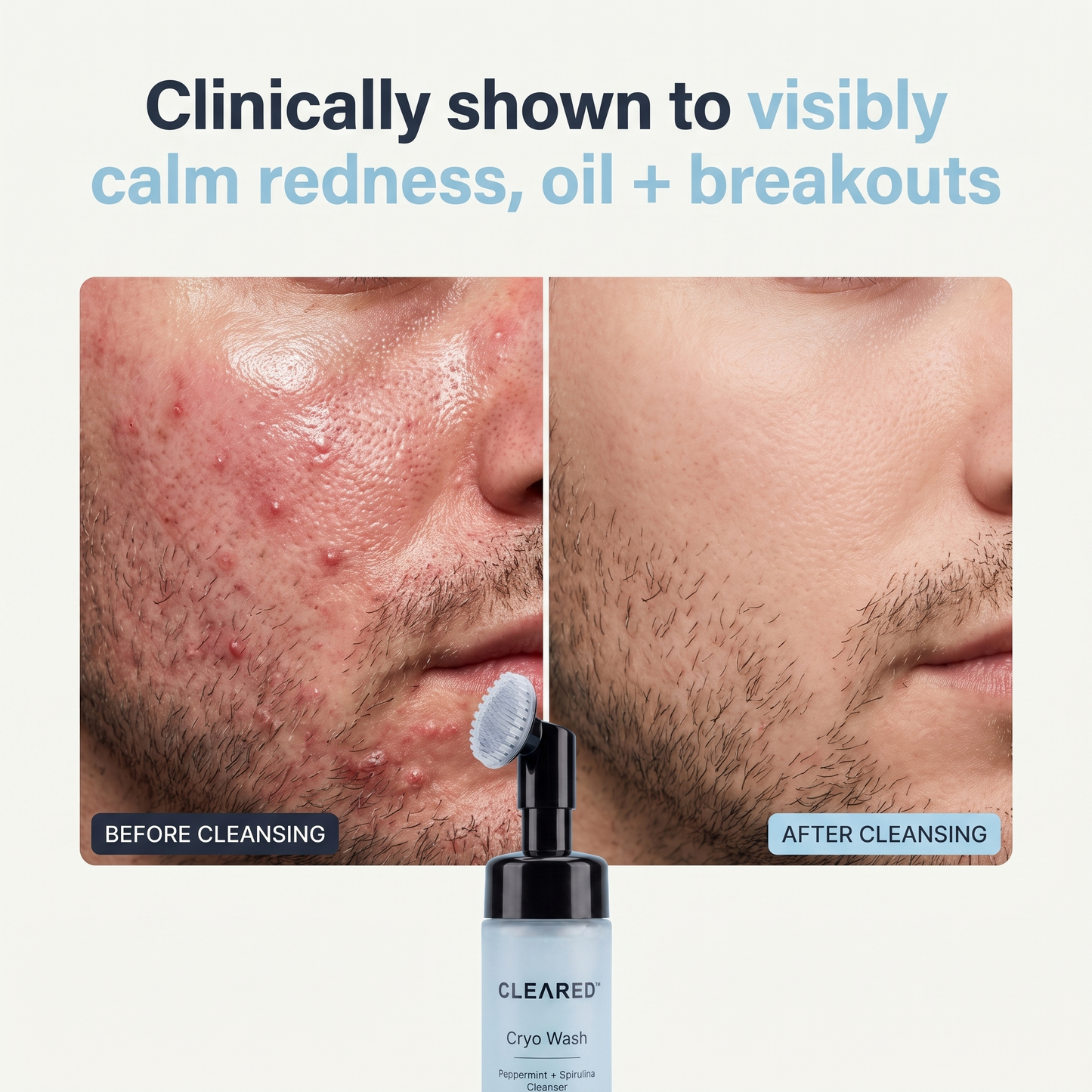 CLEARED® Cryo Wash Cleanser