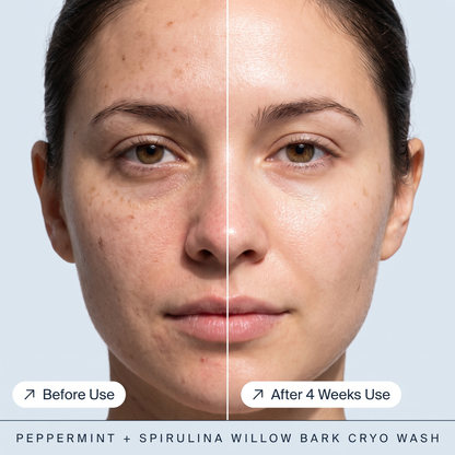 CLEARED® Cryo Wash Cleanser